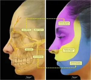 neuralgia do trigemeo