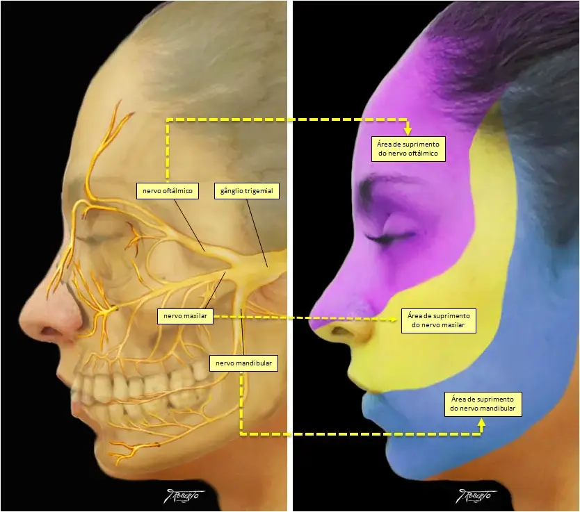 neuralgia do trigemeo